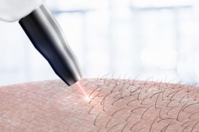 بهترین روش تبلیغ لیزر؛ جملات جذاب + تکنیک‌های افزایش فروش