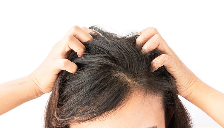 چطور بیماری های مربوط به مو را درمان کنیم؟
